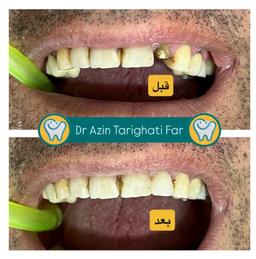 تصویر گالری آذین طریقتی فر 4