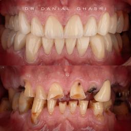 تصویر گالری دانیال قصری 2