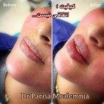 تصویر گالری پریسا معلم نیا 9