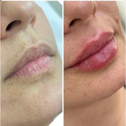 تصویر گالری ملیکا محمدزاده 10