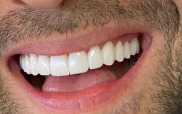 تصویر گالری دنیا رشنو 1