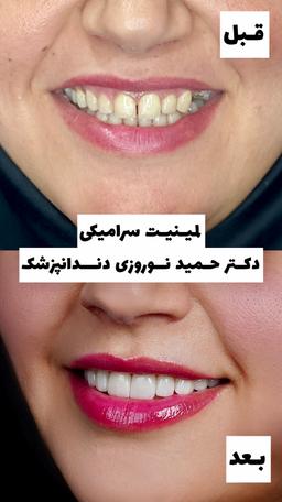 تصویر گالری حمید نوروزی 2