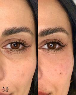 تصویر گالری ملیکا محمدزاده 2