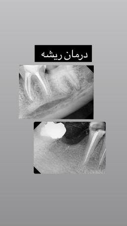 تصویر گالری سحر رضائی 12