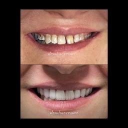 تصویر گالری سحر رضائی 1