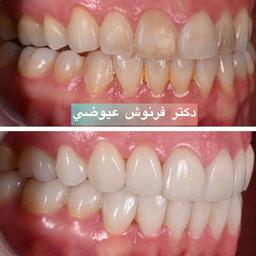تصویر گالری فرنوش عیوضی 3