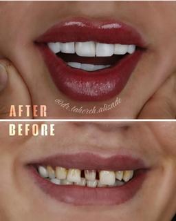 تصویر گالری طاهره علیزاده 5