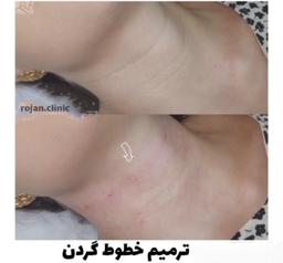 تصویر گالری محمد نورابی 10