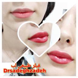 تصویر گالری حسن صادق زاده 3