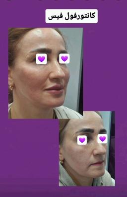 تصویر گالری مریم مدیرروستا 15