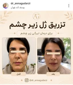 تصویر گالری آنا گودرزی 11