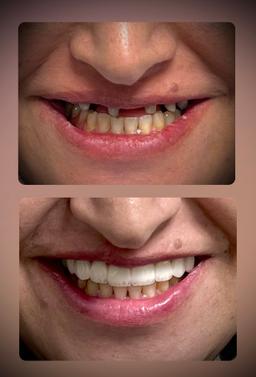 تصویر گالری سحر رضائی 5