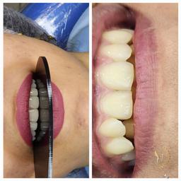 تصویر گالری فتانه غلام ضاد 4