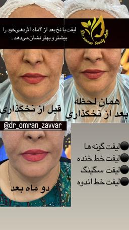 تصویر گالری عمران زوار 3