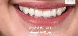 تصویر گالری نیلوفر فکری 6