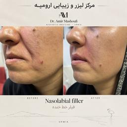 تصویر گالری امیر مشعوفی 11