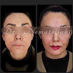 تصویر گالری امیررضا نعمت اللهی 1
