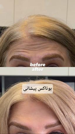 تصویر گالری زهرا ابراهیمی 12