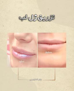 تصویر گالری آنا گودرزی 3