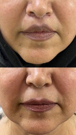 تصویر گالری رضا نوتاش 7