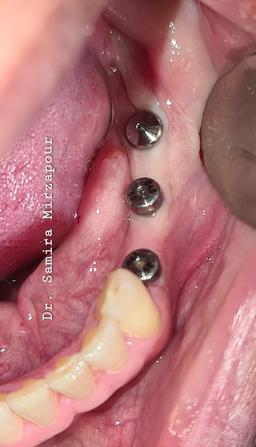 تصویر گالری سمیرا محمدمیرزاپور 8