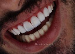 تصویر گالری زینب ایمانی 1
