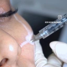 تصویر گالری نسیم محمودی 3