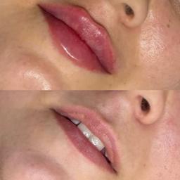تصویر گالری ملیکا محمدزاده 1