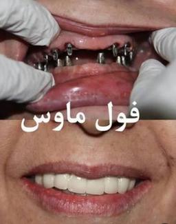 تصویر گالری شهرام سلیمی افجانی 4