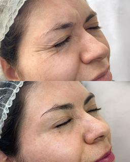 تصویر گالری ملیکا محمدزاده 9