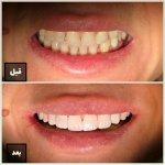 تصویر گالری سمانه فلاح 5
