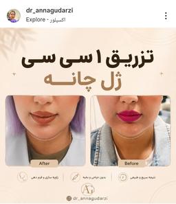 تصویر گالری آنا گودرزی 12