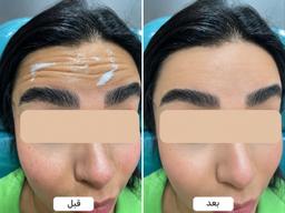 تصویر گالری علی محمد درزی بورخانی 3