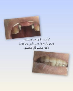 تصویر گالری محمد گل محمدی 5