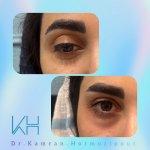 تصویر گالری کامران هرمزی پور 11