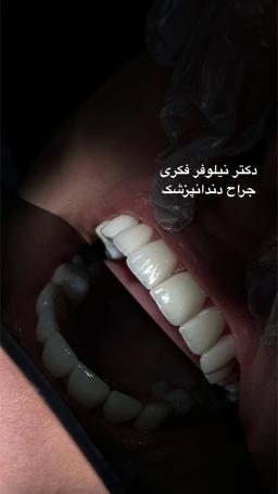 تصویر گالری نیلوفر فکری 8
