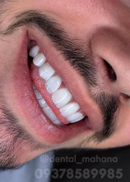 تصویر گالری اعظم ذاکری 6