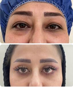 تصویر گالری رضا نوتاش 8