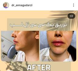 تصویر گالری آنا گودرزی 10