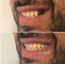 تصویر گالری زینب ایمانی 5