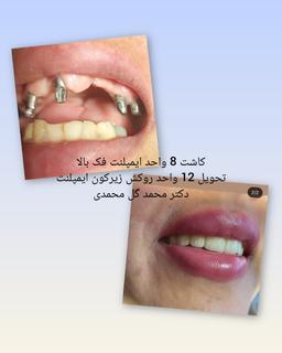 تصویر گالری محمد گل محمدی 3