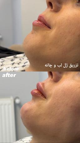 تصویر گالری زهرا ابراهیمی 5