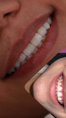 تصویر گالری اولدوز حسینی قلعه جوق 1