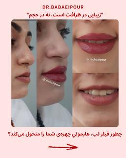 تصویر گالری فاطمه بابائی پور 3