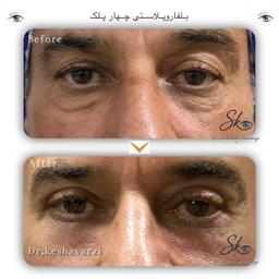 تصویر گالری سیامک کشاورزی 1