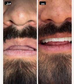 تصویر گالری مسعود حسینی 2