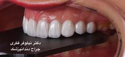 تصویر گالری نیلوفر فکری 5
