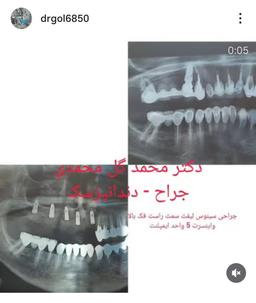 تصویر گالری محمد گل محمدی 6