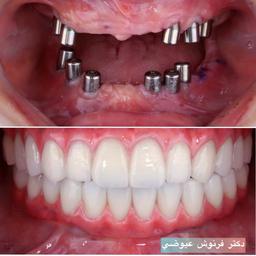 تصویر گالری فرنوش عیوضی 6