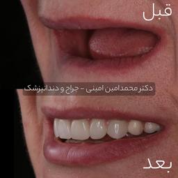 تصویر گالری سیدمحمدامین امینی 2